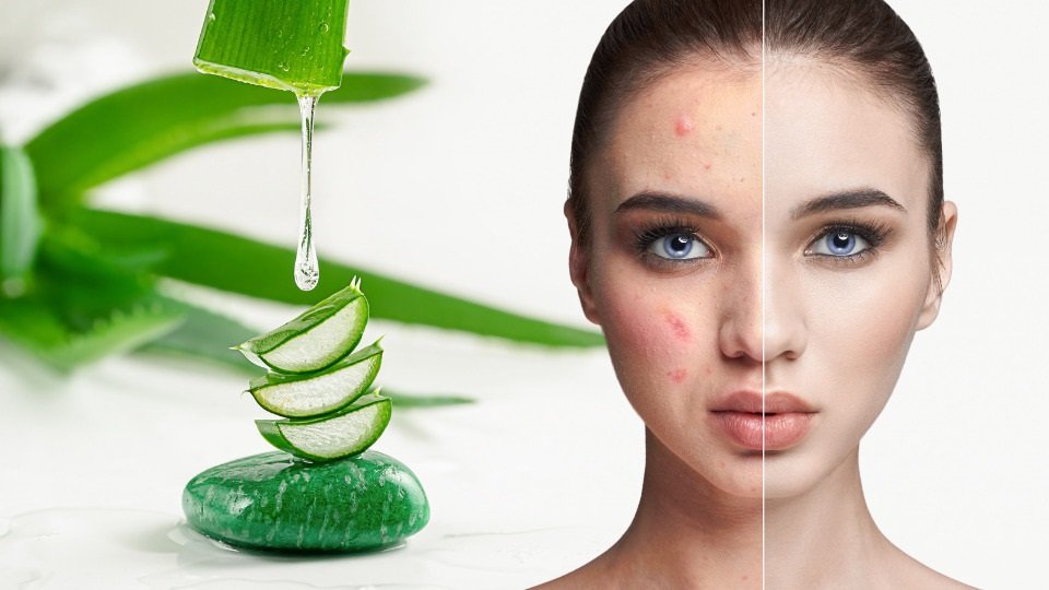 Aloe Vera Having Numerous Benefits Aloe Vera Having Numerous Benefits
